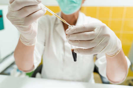Analysis of blood plasma. The laboratory assistant holds a test tube with blood from a vein in his hands and looks at it. Blood test in the laboratory. Medical scientist with glasses and maskの写真素材