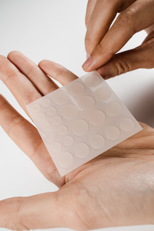 Acne patches for treatment of pimple and rosacea close-up. Facial rejuvenation cleansing cosmetology. Set of round patches for acne in hands on white backgroundの写真素材