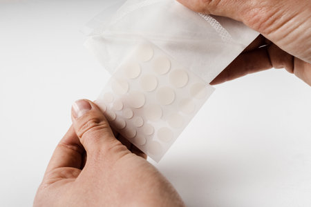 Acne patches for the treatment of pimple and rosacea close-up. Opening round patches for acne in hands on white background. Facial rejuvenation cleansing cosmetologyの写真素材