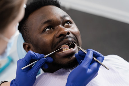Consultation with dentist at dentistry. Teeth treatment. Dentist examines african man mouth and teeth and treats toothaches. African man patient of dentistryの写真素材