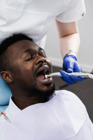 Dental drill for african man in dentistry clinic. Dentist is removing caries and filling teeth for african american patientの写真素材