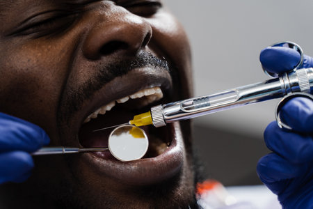 Anesthesia syringe injection close-up. Dentist injects syringe with anesthesia in mouth of african man for treatment of diseased teeth. Caries treatmentの写真素材