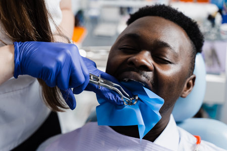 Process of installing dental cofferdam in jaw of african man for treatment teeth in stomatology. Dentist using dental dam for tooth isolationの写真素材