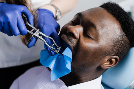 Process of installing dental cofferdam in jaw of african man for treatment teeth in stomatology. Dentist using dental dam for tooth isolationの写真素材
