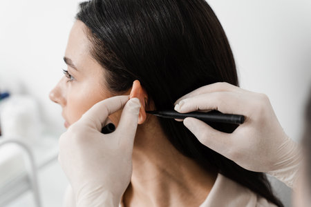 Otoplasty markup for surgical reshaping of the pinna, or outer ear for correcting an irregularity and improving appearance. Surgeon doctor marking girl ear before otoplasty cosmetic surgeryの写真素材