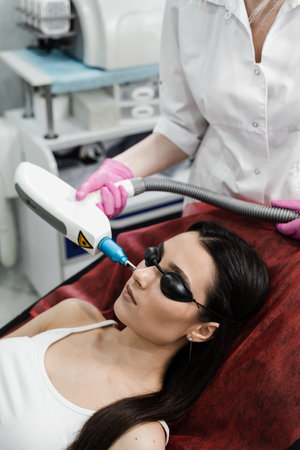 Laser removal of blood vessels on face of girl in dermatological clinic. Cosmetologist cleans face of girl from pigmentation using laser. Hardware treatmentの写真素材