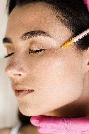 Close-up facial mesotherapy to rejuvenate skin and improve skin health and appearance. Cosmetologist is making facial mesotherapy injections for girlの写真素材
