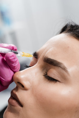 Beautician is injecting botulinum toxin to correct mimic wrinkles and hyperhidrosis for young girl. Botulinum toxin to relax and neutralize overactive muscles that cause wrinklesの写真素材