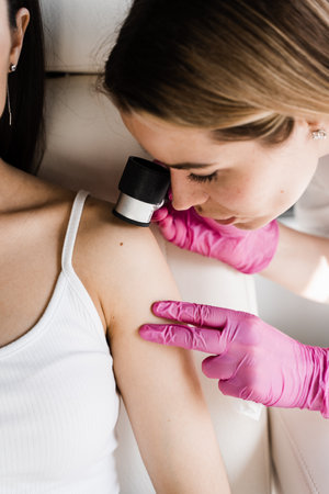 Dermatologist examines moles and birthmarks of girl patient using dermatoscope. Dermatoscopy of skin lesions and moles with dermatoscope for preventing skin cancer and melanomaの写真素材
