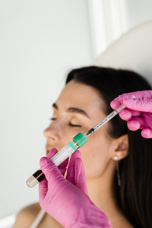 Platelet Rich Plasma PRP for improves skin volume and texture, reduces flaccidity and fine wrinkles. Cosmetologist with test tube with plasma of patient girl for PRP Platelet Rich Plasma procedureの写真素材