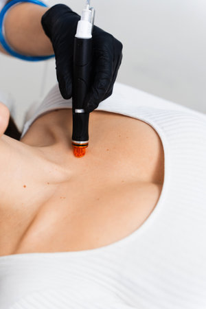 Using hydrafacial hardware cosmetology devise to improve skin condition. Rejuvenating skin with...