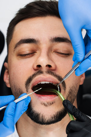 Initial examination of the patients oral cavity by a dentist. Handsome man is having preventive...