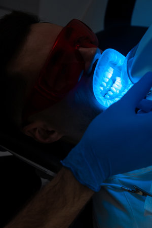 Ultraviolet teeth whitening procedure in dental clinic. Patient whitens his teeth while treatment in...