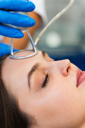 Laser CO2 resurfacing skincare procedure. Removing wrinkles and scars through CO2 laser resurfacing