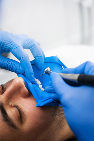 Teeth preparation in dental dam before drilling in dental clinic. Dentist uses rubber dam to isolate...
