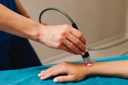 Infrared treatment of hand to manage pain, numbness and tingling. Doing laser therapy to improve...
