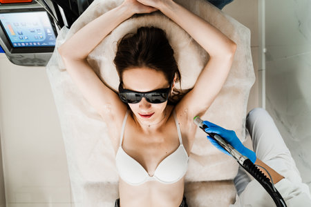 Painless laser epilation removal of hair underarms. Girl is having a laser procedure to get rid of armpit hair for a long time for sensitive skin. Destroying hair follicles for a long-last effectの写真素材