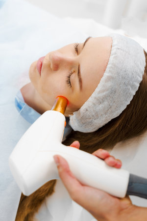 Laser treatment of rosacea by dermatologist. Painless rosacea treatment in beauty clinic. Removal rosacea of dilated small vessels on patient face with IPL ultrasound laserの写真素材