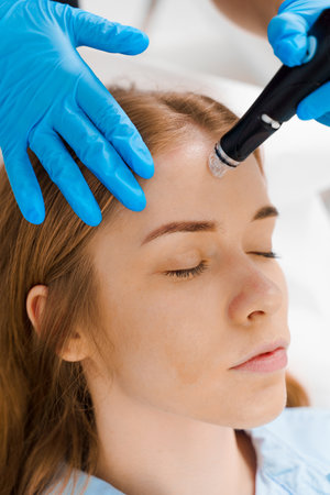 HydraFacial purifying procedure with medical device in beauty center. Beautician doing facial...