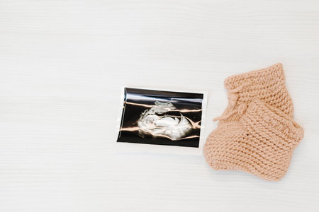 Happy expecting for baby birth. Ultrasound sonogram picture of a baby photograph and a pair of knitted baby bootiesの写真素材