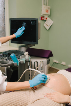 Gynecologist uses ultrasound scanner for gynecology checkup and tells patient about embryo on the appointment. Checking fetus health at the gynecology hospitalの写真素材