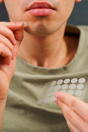 Using acne pimple patch to clean the face from zits at home. Male facial beauty concept