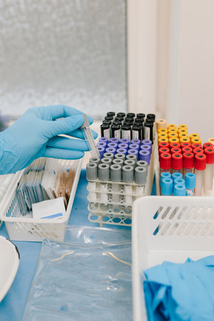 Blood sampling in pregnant patients for illnesses checkup. Gynecologist holds blood collection tubes for laboratory tests in the gynecology clinicの写真素材