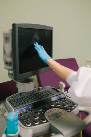 Gynecologist uses ultrasound scanner for gynecology checkup and tells patient about embryo on the appointment. Checking fetus health at the gynecology hospitalの写真素材