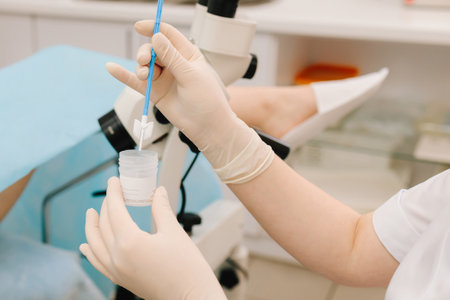 Pap smear sample collection. Gynecologist collects a Pap smear sample for cervical screening....
