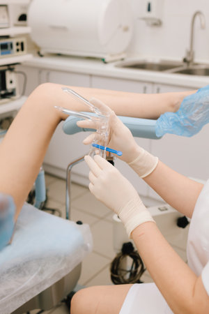 Close-up of gynecology tools used for Pap smear testing. Speculum and brush close-up. Gynecologist prepares speculum and brush for cervical screeningの写真素材