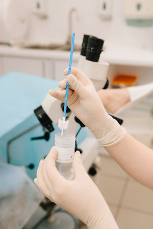Pap smear sample collection. Gynecologist collects a Pap smear sample for cervical screening. Cervical screening procedure with Pap smear toolの写真素材