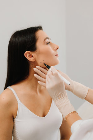 Bruxism injection facial for a treatment with botulinum toxin in an aesthetic medicine clinic. Bruxism injecting for teeth grinding by a cosmetologistの写真素材