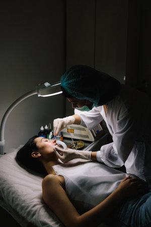 Laser dermatologic treatment for nevus and mole removal. Aesthetic laser removal of nevi and benign growths. Dermatologist performs precise laser removal of a facial nevus and other benign lesions.の写真素材