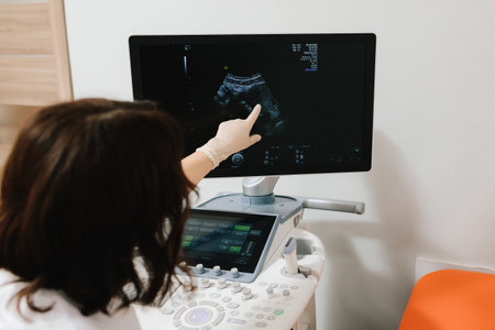 Ultrasound Scan on Monitor. Ultrasound machine shows detailed internal imaging on screen. The ultrasound monitor displays a clear diagnostic image during patient examinationの写真素材