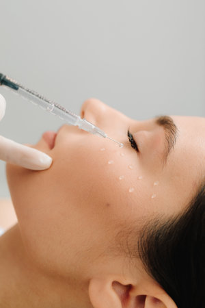 Facial mesotherapy to rejuvenate skin and improve skin health and appearance. Cosmetologist is making facial mesotherapy injections for girlの写真素材