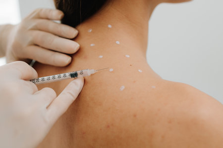 Preparation skin marking for migraine therapy. Remedy of headache problem and pain problems. Injection in marked dotes on back for migraine treatment by doctorの写真素材