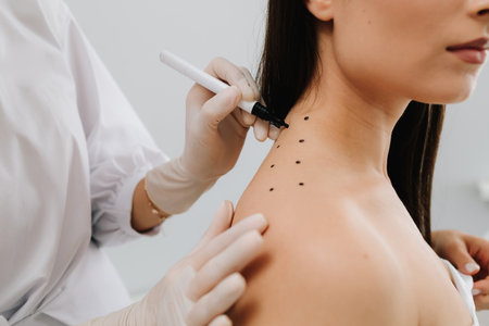 Doctor draws markings on the skin of the back for migraine treatment. Markup skin from migraine and...