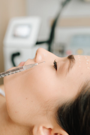 Facial biorevitalization to restore hydration and elasticity. Biorevitalization injections to...