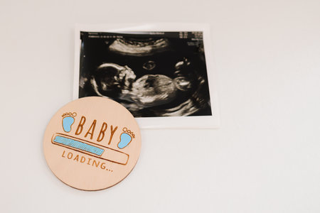 Ultrasound sonogram picture of a baby photograph. Happy expecting for baby birthの写真素材