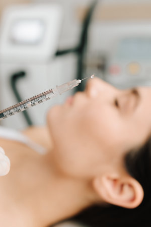 Biorevitalization injections to enhance skin firmness and moisture balance. Biorevitalization injections provide deep moisturizing. Facial biorevitalization to restore hydration and elasticityの写真素材