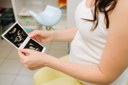 Filming precious moments of motherhood with sonogram. Pregnant woman holds and looks at her baby ultrasound photo on her bellyの写真素材