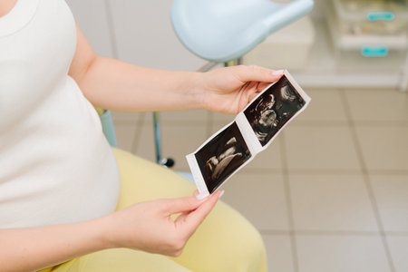 Pregnant woman holds and looks at her baby ultrasound photo on her belly. Filming precious moments of motherhood with sonogramの写真素材