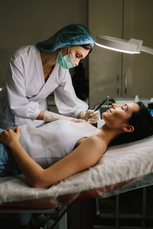 Dermatologist performs precise radio wave mole removal using radiofrequency surgery. Close-up of radio wave dermatologic mole excision. Radiofrequency mole removal under clinical conditionsの写真素材