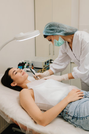 Dermatologist performs precise radio wave mole removal using radiofrequency surgery. Close-up of radio wave dermatologic mole excision. Radiofrequency mole removal under clinical conditionsの写真素材