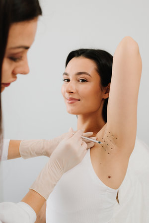 Hyperhidrosis injection for underarm. Intradermal injection procedure for underarm hyperhidrosis....
