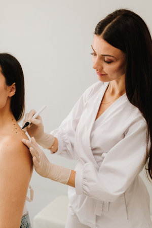 Markup skin from migraine and pain for therapy. Doctor draws markings on the skin of the back for migraine treatmentの写真素材