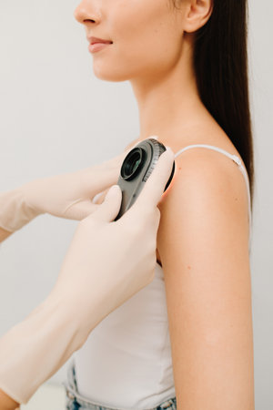 Dermatologist Examining Girl Skin with Dermatoscope. Dermatoscopic analysis aids in the detection of suspicious skin spots using dermatoscope during a clinical examの写真素材