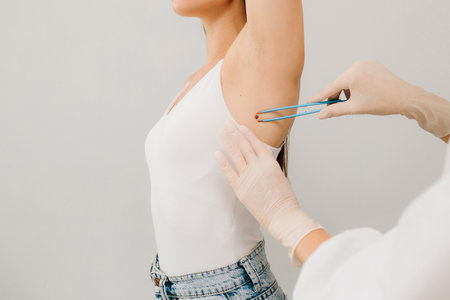 Examination of skin neoplasm and lesions of young woman. Dermatologist examines moles or birthmark of girl patient for revention of melanoma and skin cancer close-up. Checking for benign molesの写真素材