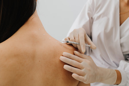 Injection in marked dotes on back for migraine treatment by doctor. Preparation skin marking for migraine therapy. Remedy of headache problem and pain problemsの写真素材