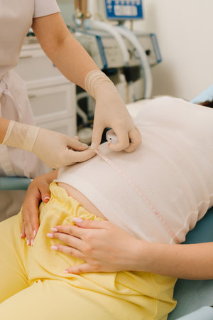 Gynecologist checks size of the woman belly in the clinic. Gynecologist measures pregnant belly with measuring tape to follow the growth of the baby on the appointmentの写真素材